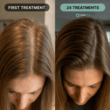Hair ResQ™ Clinical Regrowth Protocol 2.0 Adenosine + GHK-Cu Targeted Micro-Infusion Delivery For Women