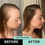 Hair ResQ™ Clinical Regrowth Protocol 2.0 Adenosine + GHK-Cu Targeted Micro-Infusion Delivery For Women