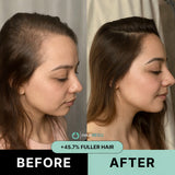 Hair ResQ™ Clinical Regrowth Protocol 2.0 Adenosine + GHK-Cu Targeted Micro-Infusion Delivery Women