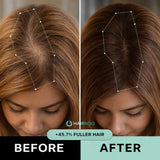 Hair ResQ™ Clinical Regrowth Protocol 2.0 Adenosine + GHK-Cu Targeted Micro-Infusion Delivery Women