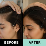 Hair ResQ™ Clinical Regrowth Protocol 2.0 Adenosine + GHK-Cu Targeted Micro-Infusion Delivery Women