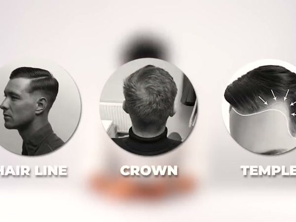 Hairline crown temple