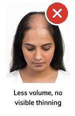 Less volume, no visible thinning