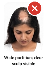 Wide partition, clear scalp visible