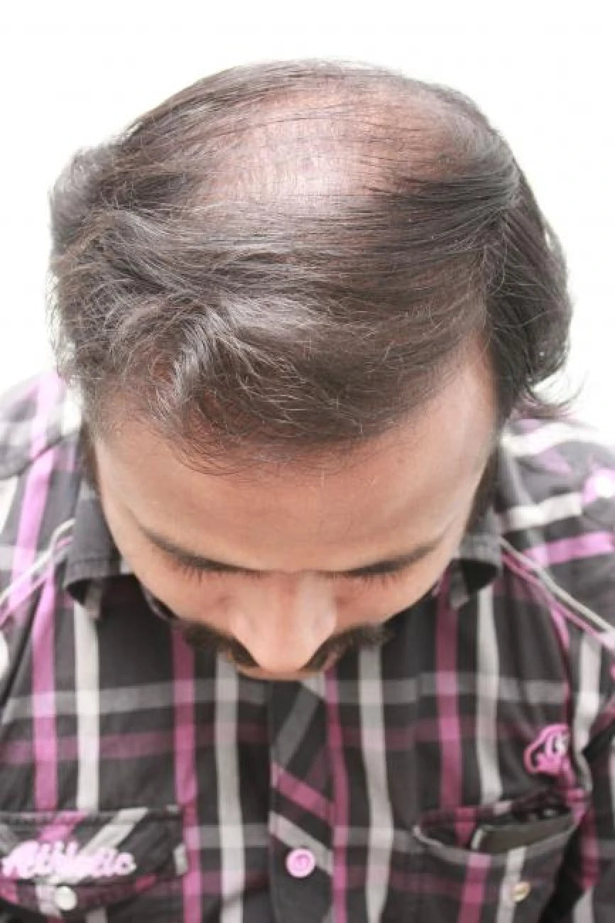 Ahmed after transformation