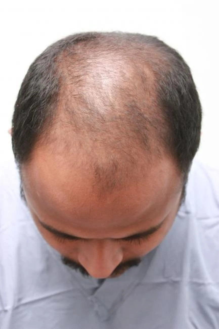 Ahmed before transformation