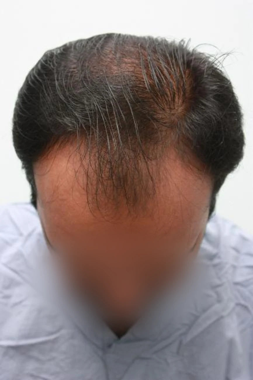 Kamran before transformation