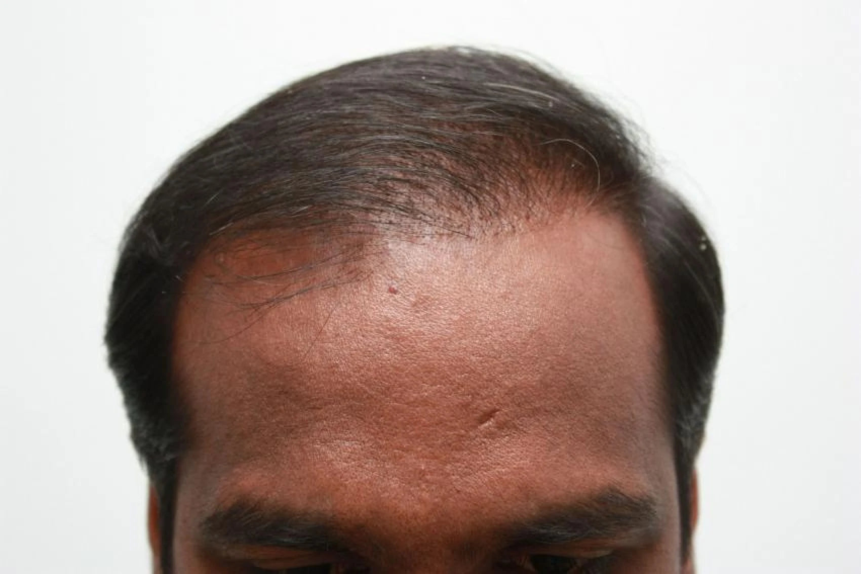 Faisal after transformation