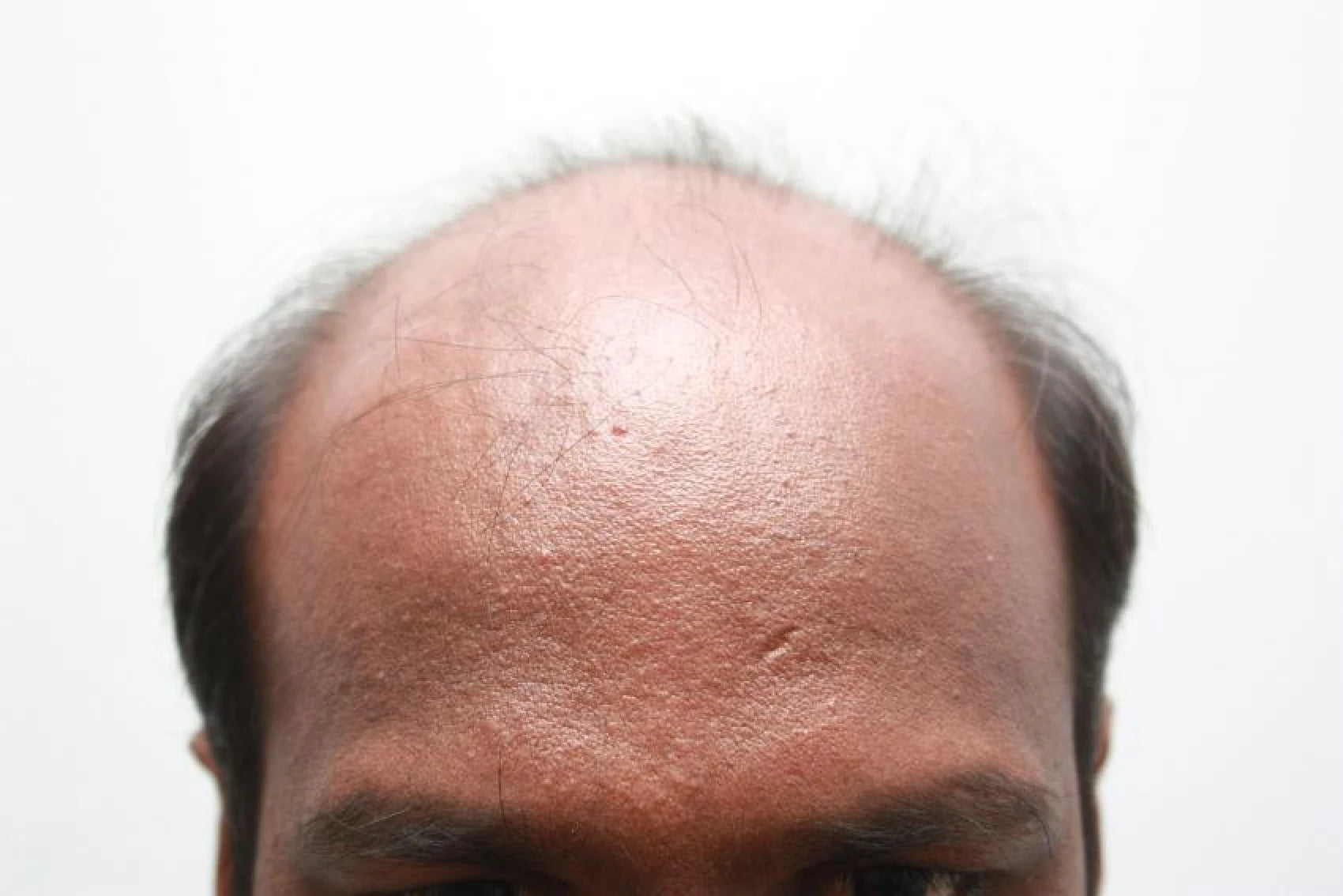 Faisal before transformation