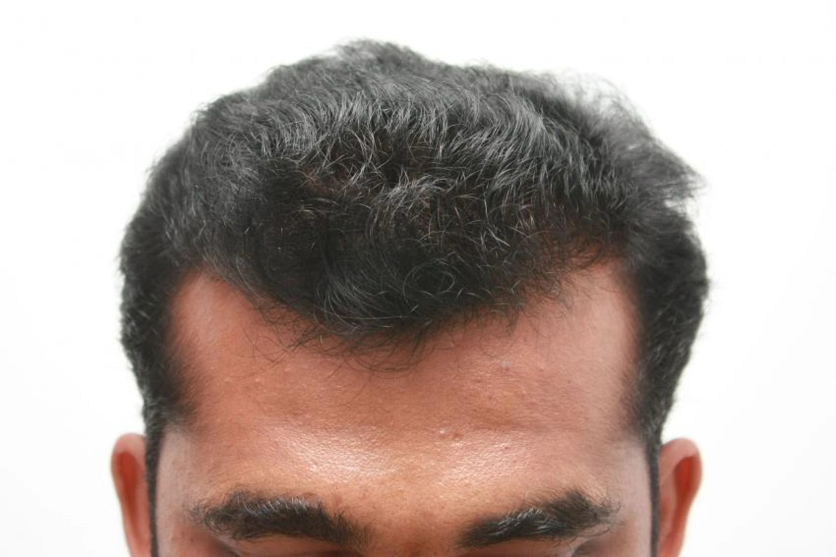 Imran after transformation