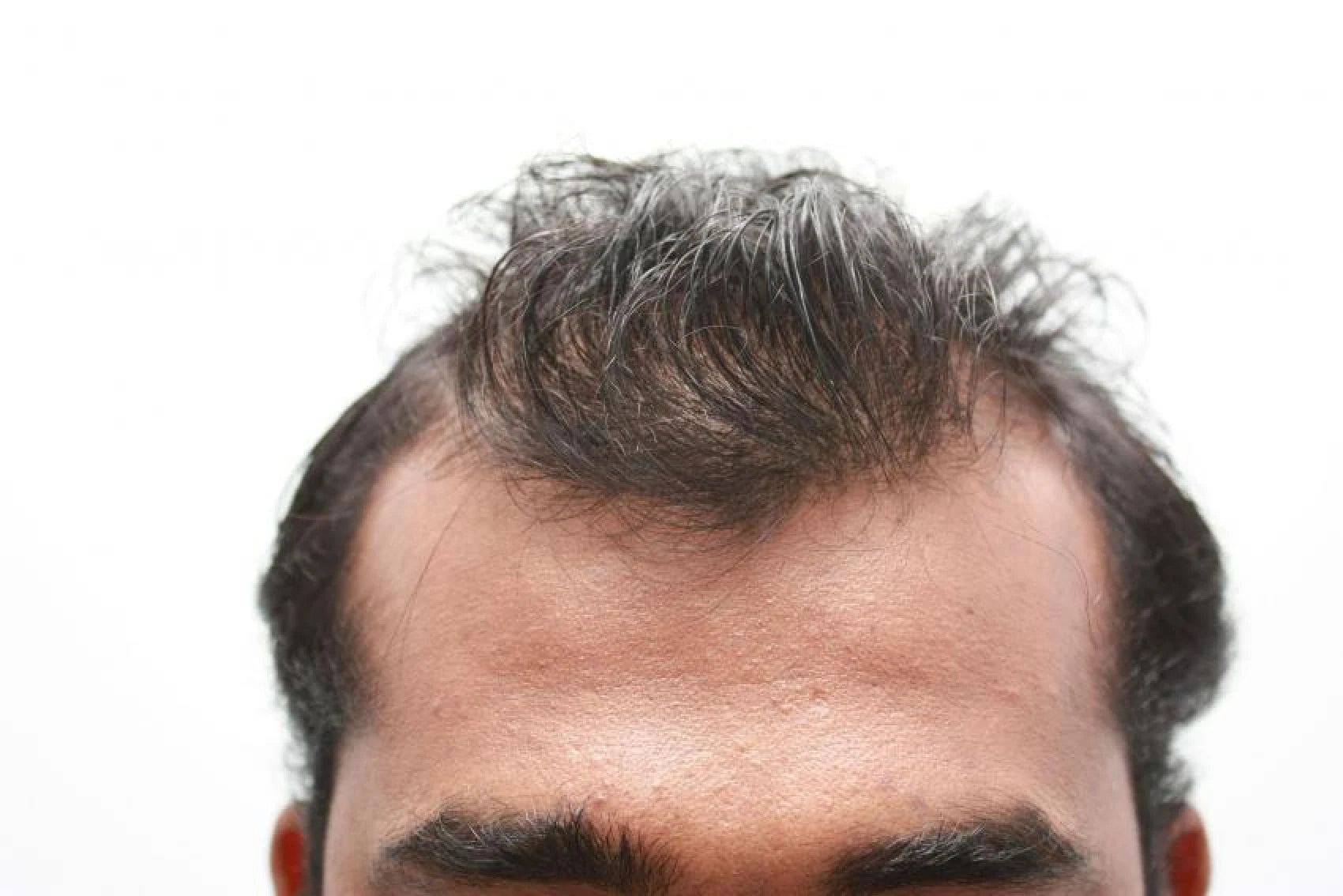 Imran before transformation