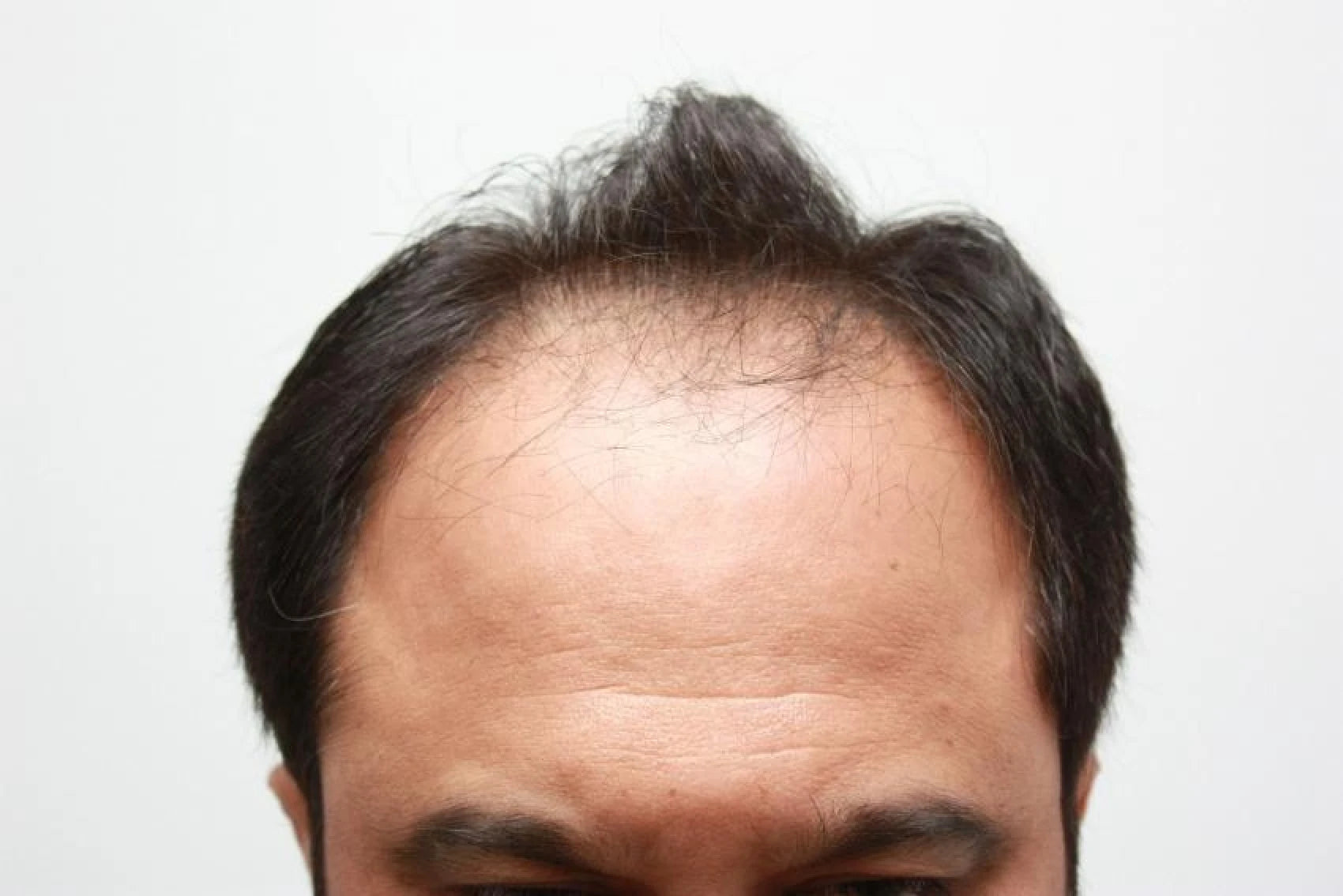 Naveed before transformation