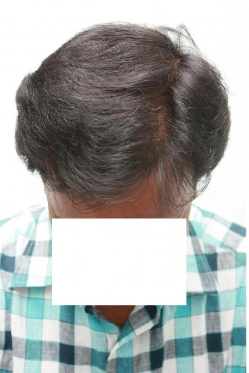 Rizwan after transformation