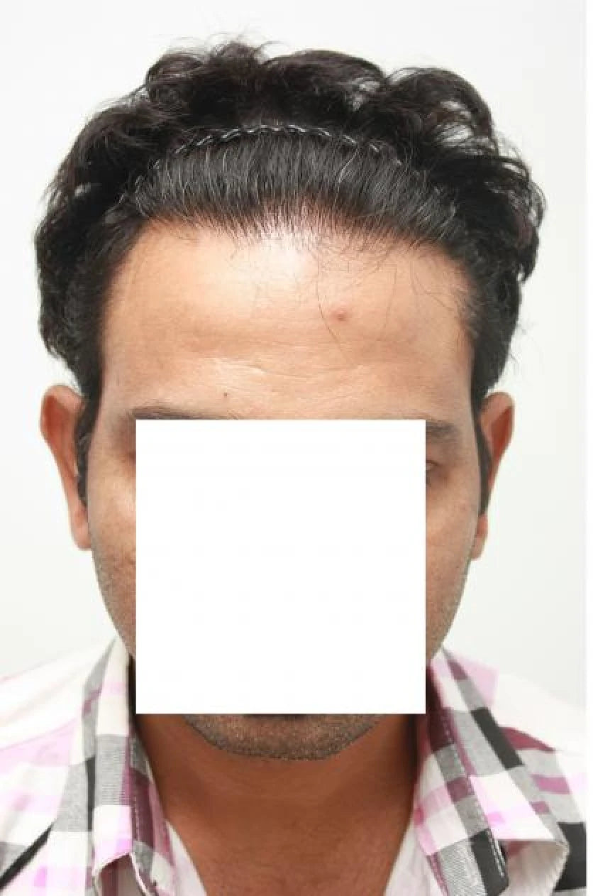 Shahid after transformation
