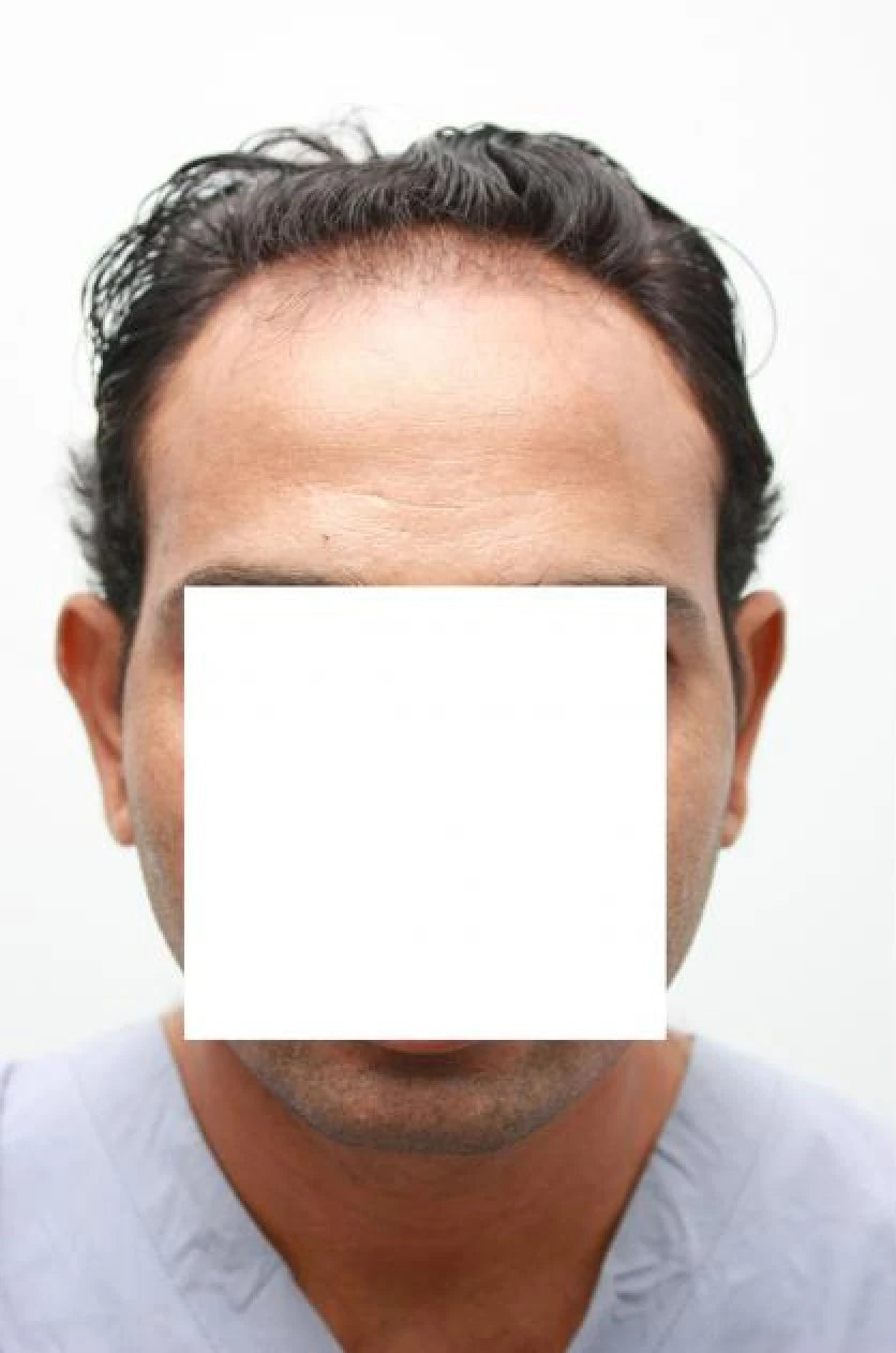 Shahid before transformation