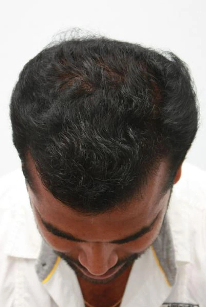 Hassan after transformation