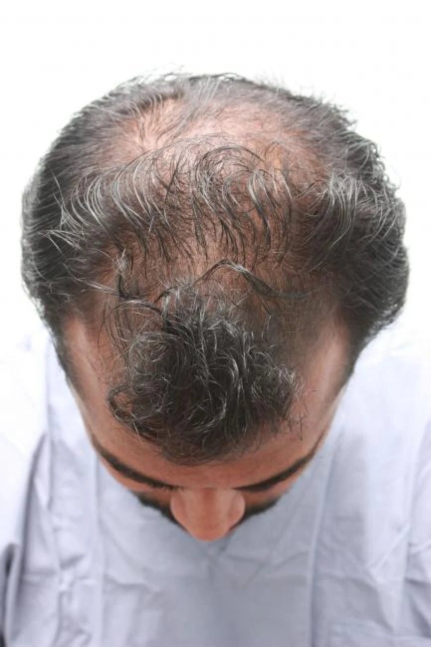 Hassan before transformation