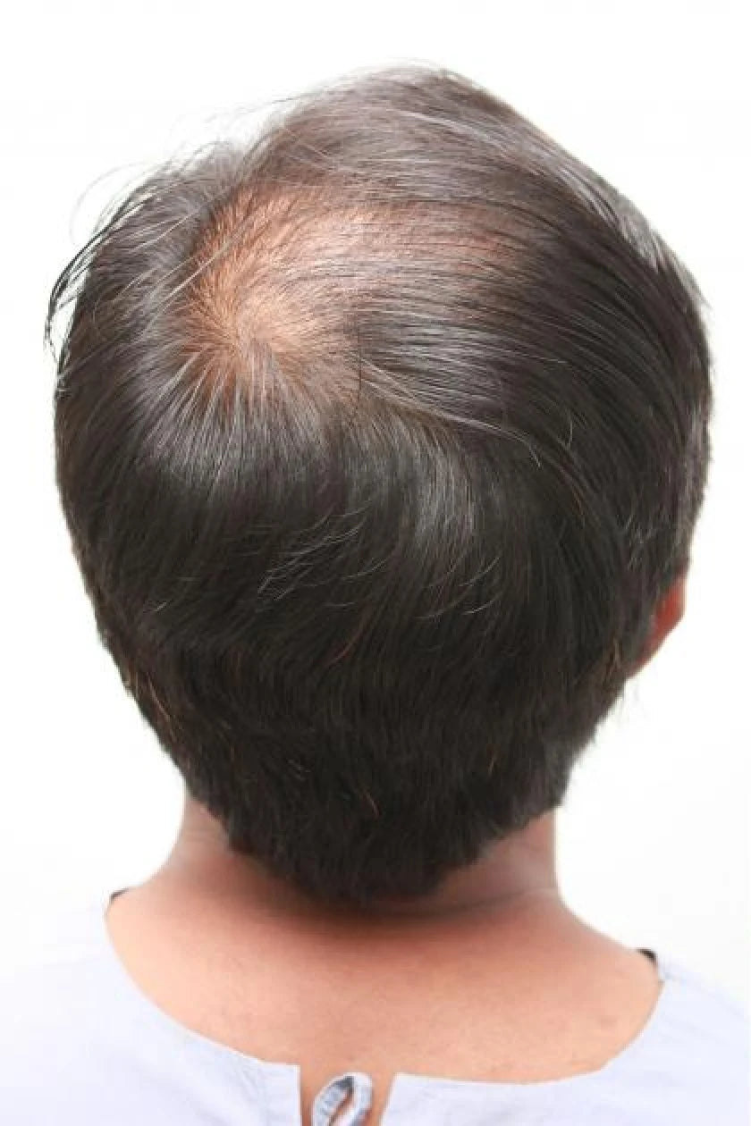 Usman before transformation