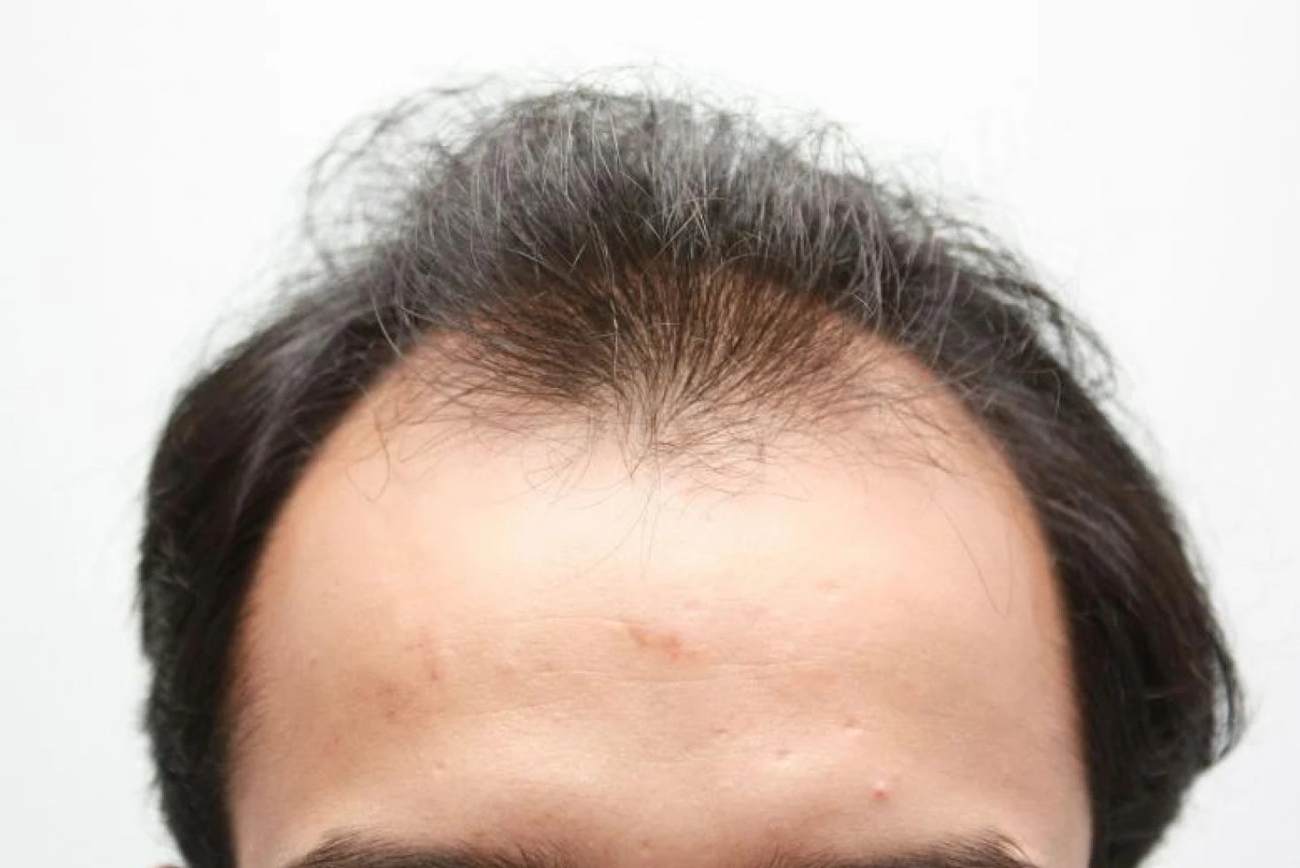Saad before transformation