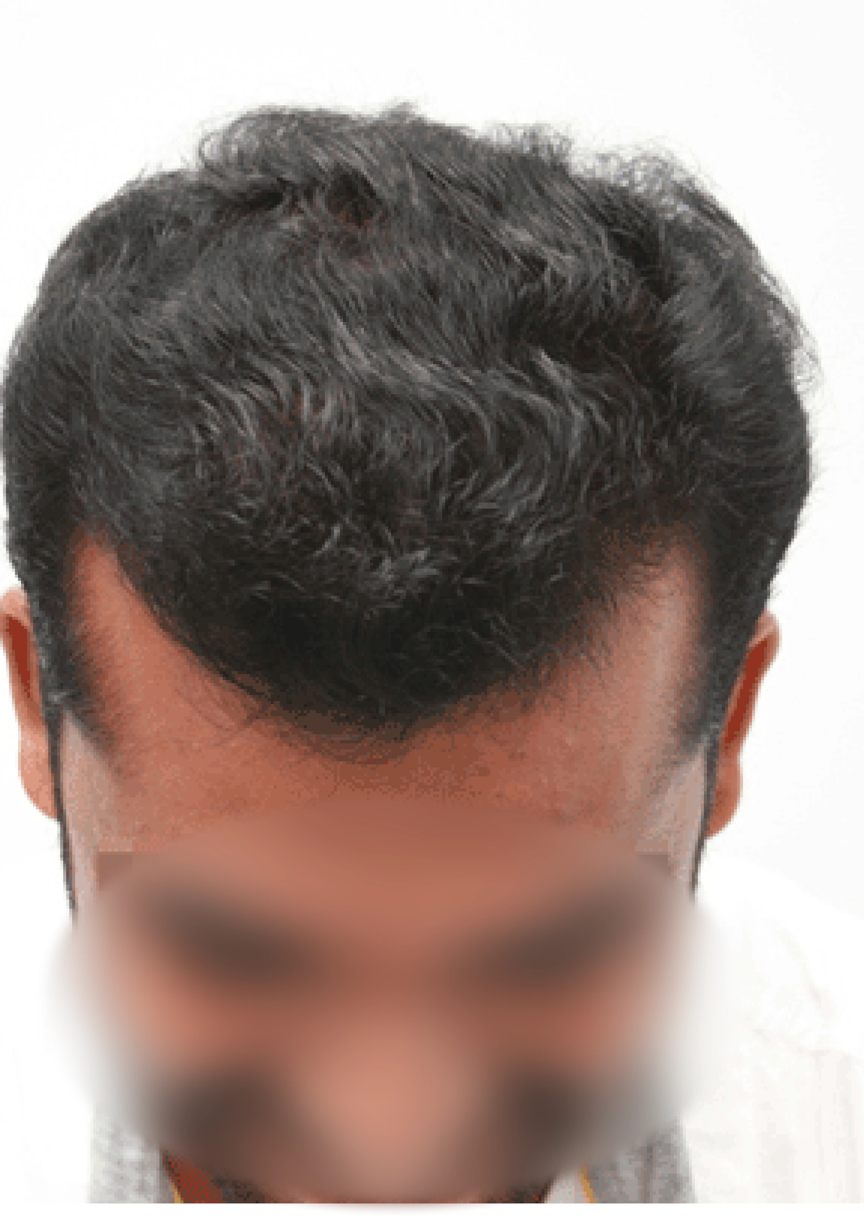 Omar after transformation