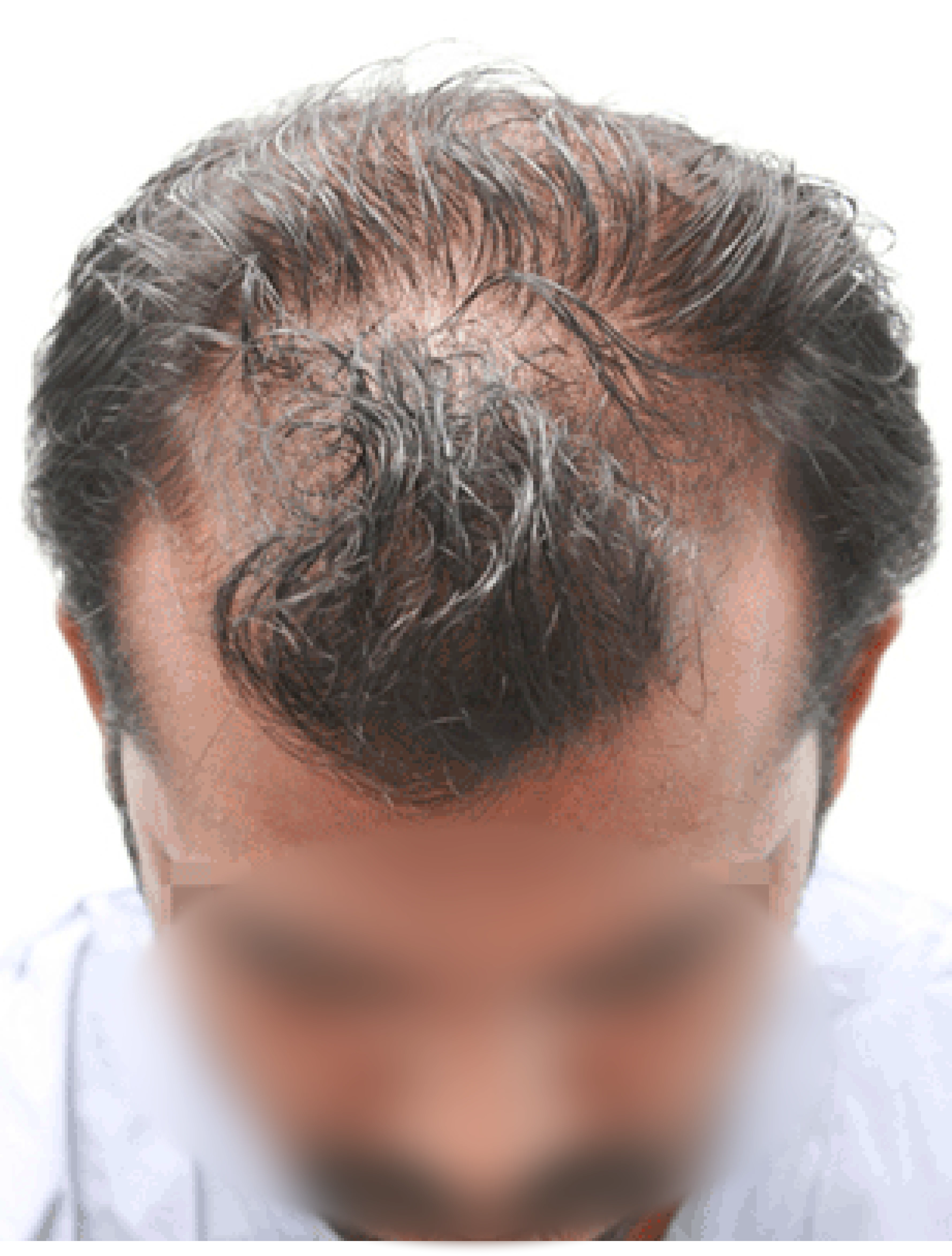 Omar before transformation