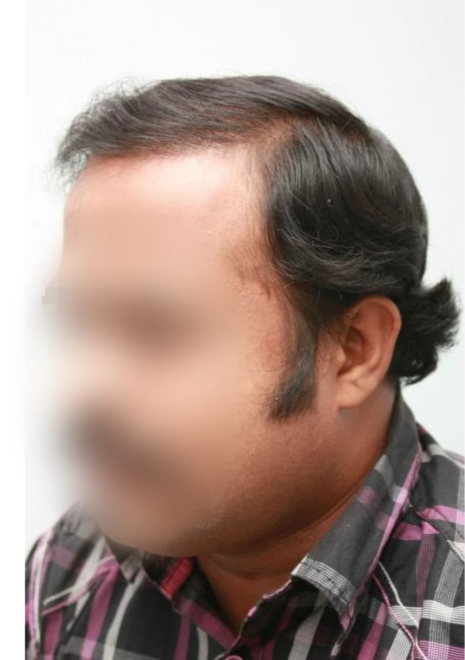 Tariq after transformation