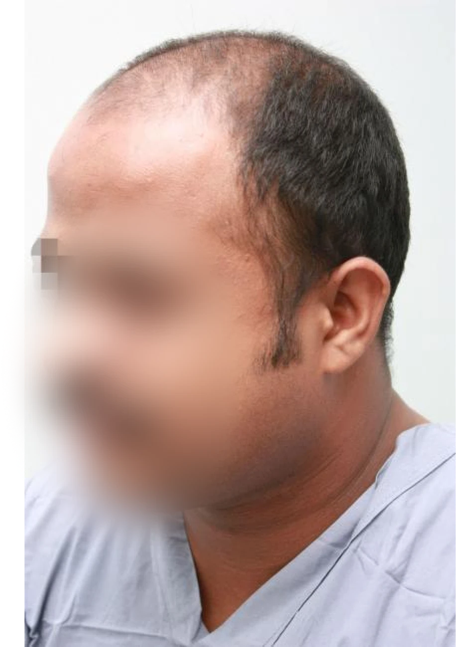 Tariq before transformation